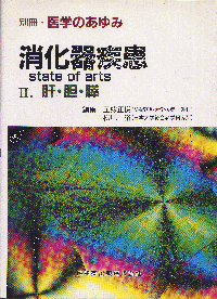 펾\state of arts  IID́E_EX