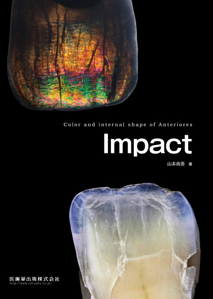 Impact@Color and internal shape of Anteriores