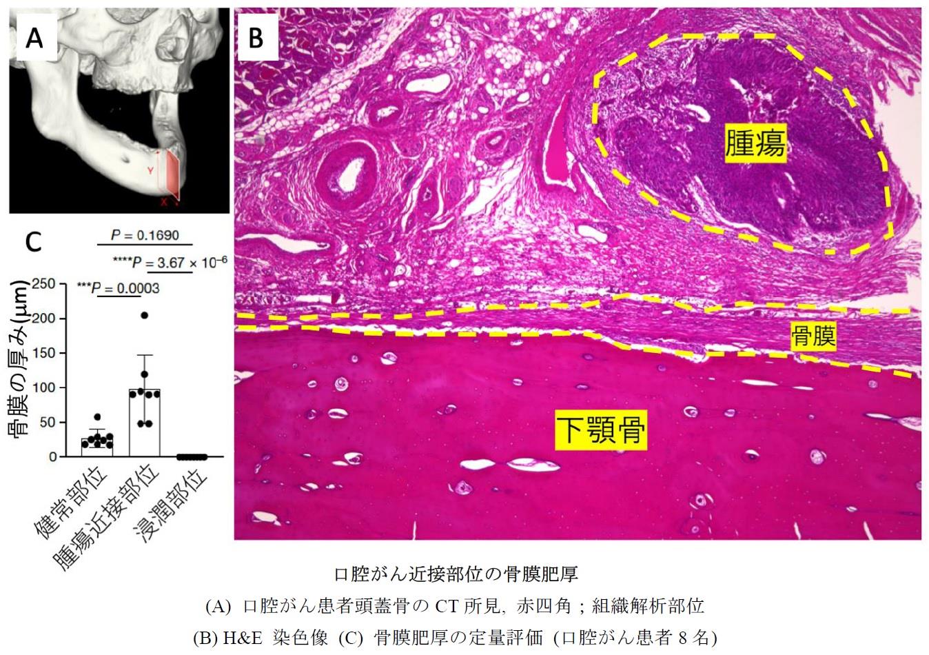 歯の移動の臨床バイオメカニクス : 骨と歯根膜のダイナミズム 歯の移動の臨床バイオメカニクス―骨と歯根膜のダイナミズム