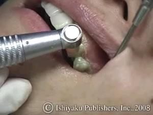 デンタルハイジーン』第28巻5号 WEB連動企画／Ishiyaku Dent Web