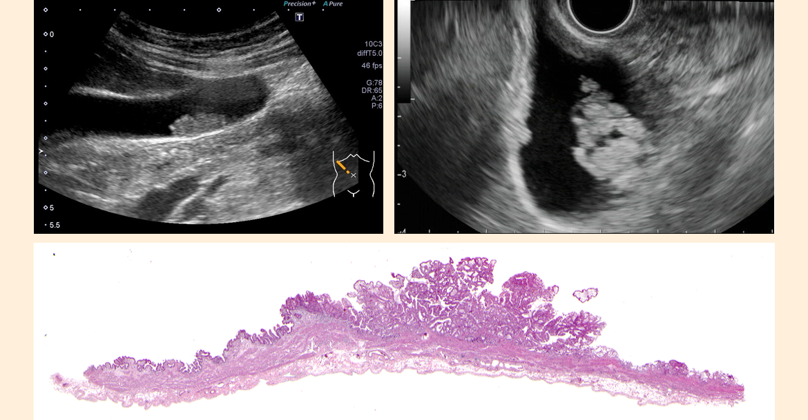 テストはどのように行われますか?