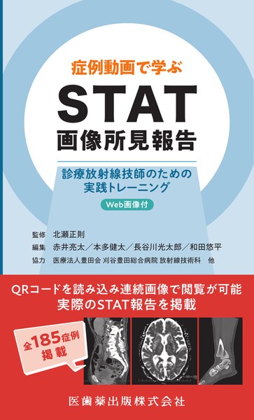 STAT摜