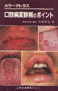 カラーアトラス 口腔病変診断のポイント／医歯薬出版株式会社