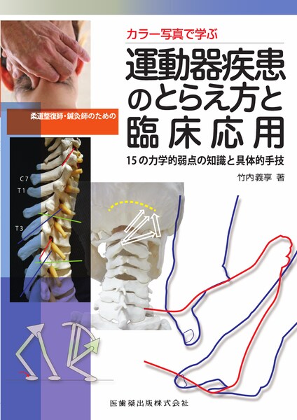 カラー写真で学ぶ 柔道整復師・鍼灸師のための運動器疾患のとらえ方と