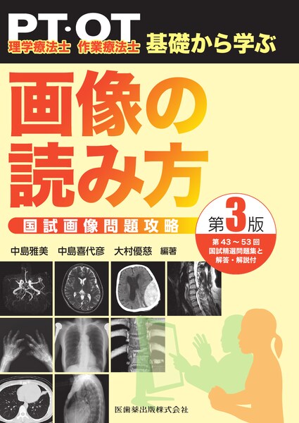 教科書　理学療法　作業療法　PT OT ST 心理学　医学　FIM SIAS