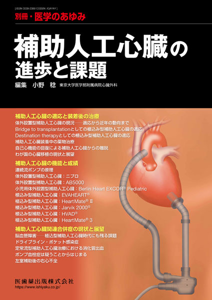 補助人工心臓の進歩と課題
