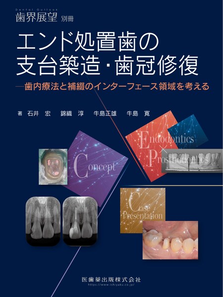 月刊「歯界展望」別冊 エンド処置歯の支台築造・歯冠修復 歯内療法と補綴のインターフェース領域を考える