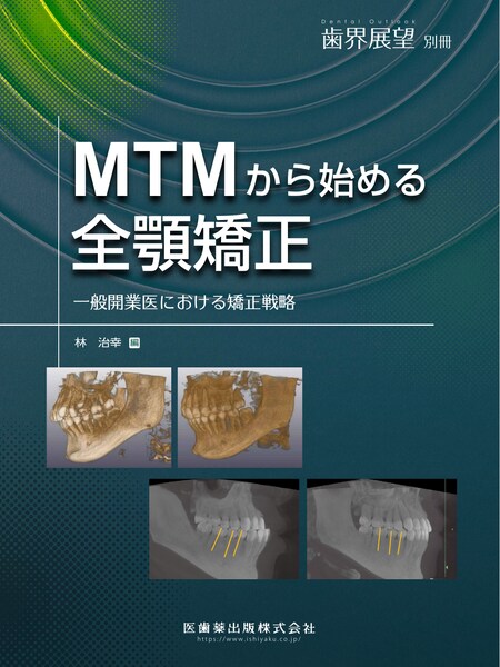 MTMから始める全顎矯正