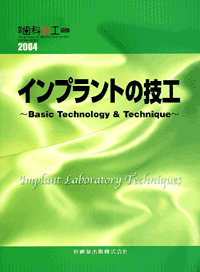 月刊「歯科技工」別冊 インプラントの技工 Basic Technology 