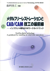 月刊「歯科技工」別冊 メタルフリーレストレーションとCAD/CAM技工の最前線　インプラント時代のラボワークガイドブック