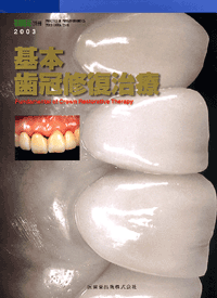 基本 歯冠修復治療