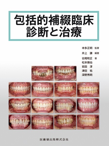 包括的補綴臨床診断と治療