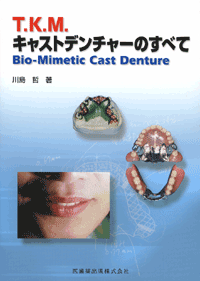 T.K.M.LXgf`[ׂ̂ā@Bio-Mimetic Cast Denture