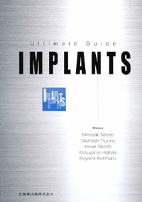 Ultimate Guide IMPLANTS