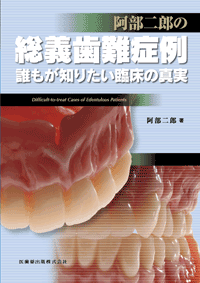 阿部二郎の　総義歯難症例　誰もが知りたい臨床の真実