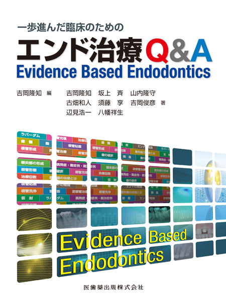 一歩進んだ臨床のための　エンド治療Q&amp;A　Evidence Based Endodontics