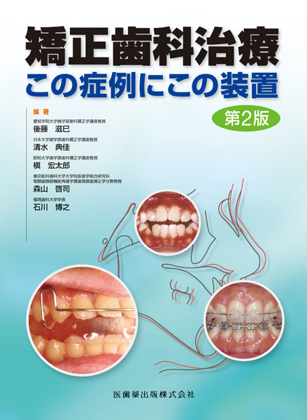 矯正歯科治療　この症例にこの装置　第2版