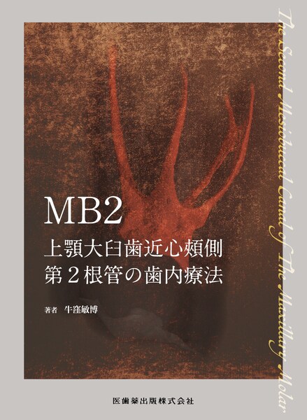 MB2