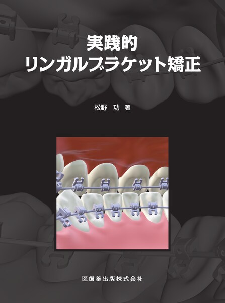 実践的リンガルブラケット矯正/医歯薬出版株式会社