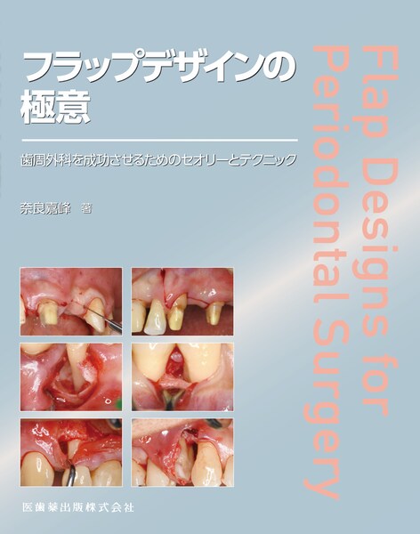 フラップデザインの極意