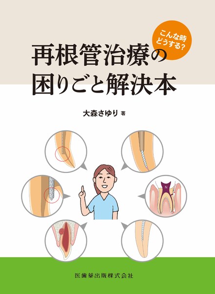 再根管治療の困りごと解決本