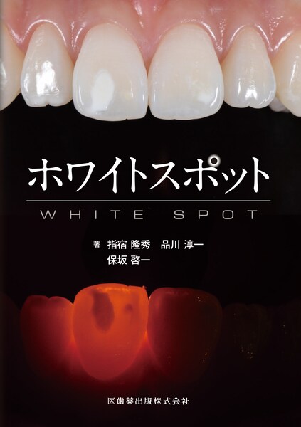 ホワイトスポット