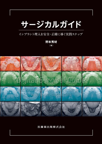 サージカルガイド　インプラント埋入を安全・正確に導く実践ステップ