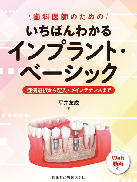 いちばんわかるインプラント・ベーシック
