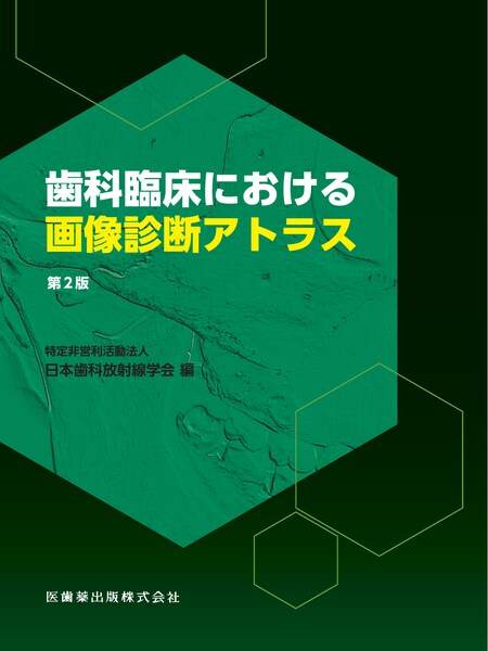 ステップで使いこなそう 歯科用CTの完全活用 画像診断体験プログラム