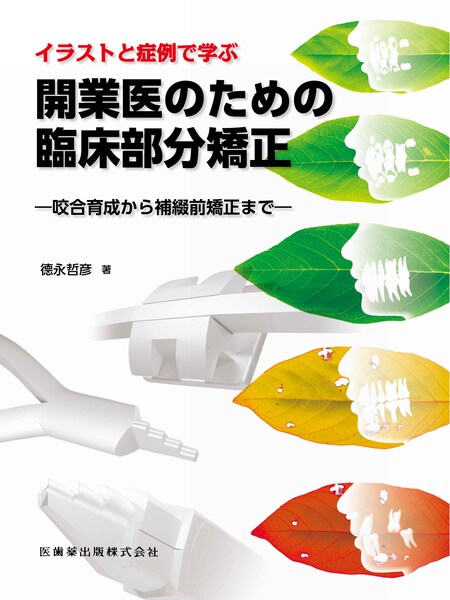 イラストと症例で学ぶ 開業医のための臨床部分矯正 咬合育成から補綴前矯正まで 医歯薬出版株式会社