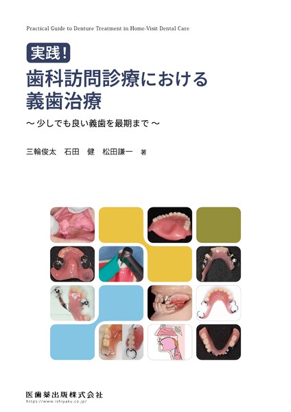 歯科訪問診療における義歯治療