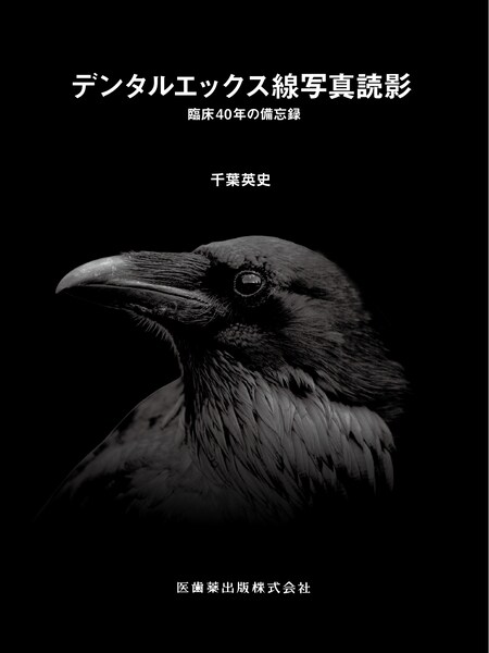 デンタルエックス線写真読影