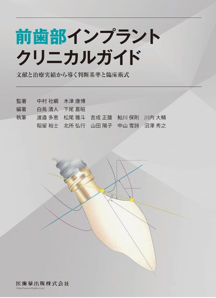 前歯部インプラントクリニカルガイド