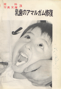 歯科写真文庫24　乳歯のアマルガム修復