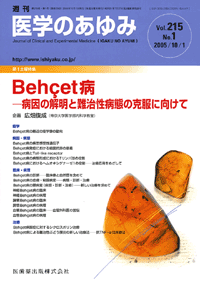 Behcet病