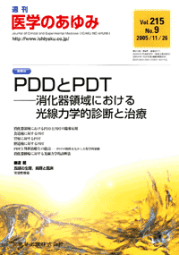 PDDとPDT