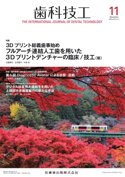 フルアーチ連結人工歯を用いた3Dプリントデンチャーの臨床/技工(後)