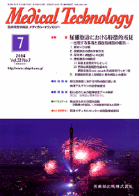 尿細胞診における特徴的所見