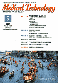 深部静脈血栓症