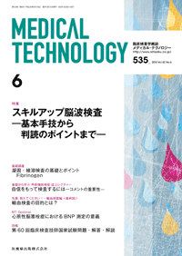 Medical Technology 42巻6号 スキルアップ脳波検査 －基本手技から判読 