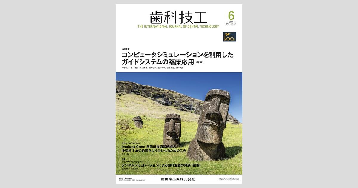 歯科技工 49巻6号 コンピュータシミュレーションを利用した