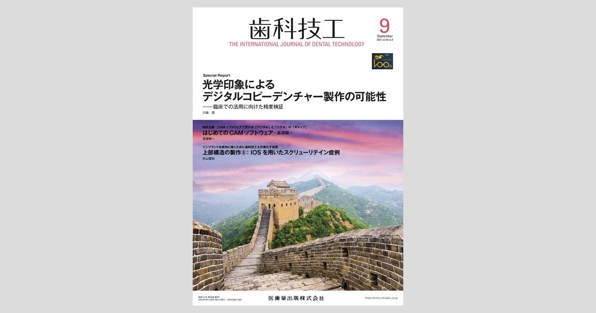 歯科技工 49巻9号 光学印象によるデジタルコピーデンチャー製作の可能