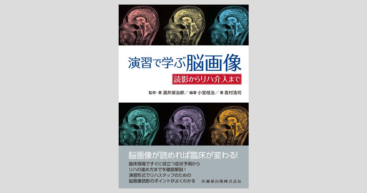 演習で学ぶ脳画像 読影からリハ介入まで/医歯薬出版株式会社