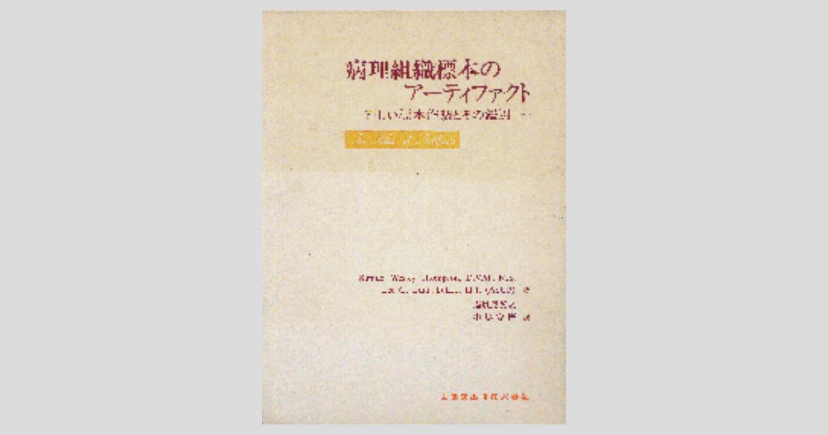 神経病理標本の見方・考え方　裁断済み 神経病理標本の見方・考え方 | 水谷 俊雄 |本 | 通販 | Amazon
