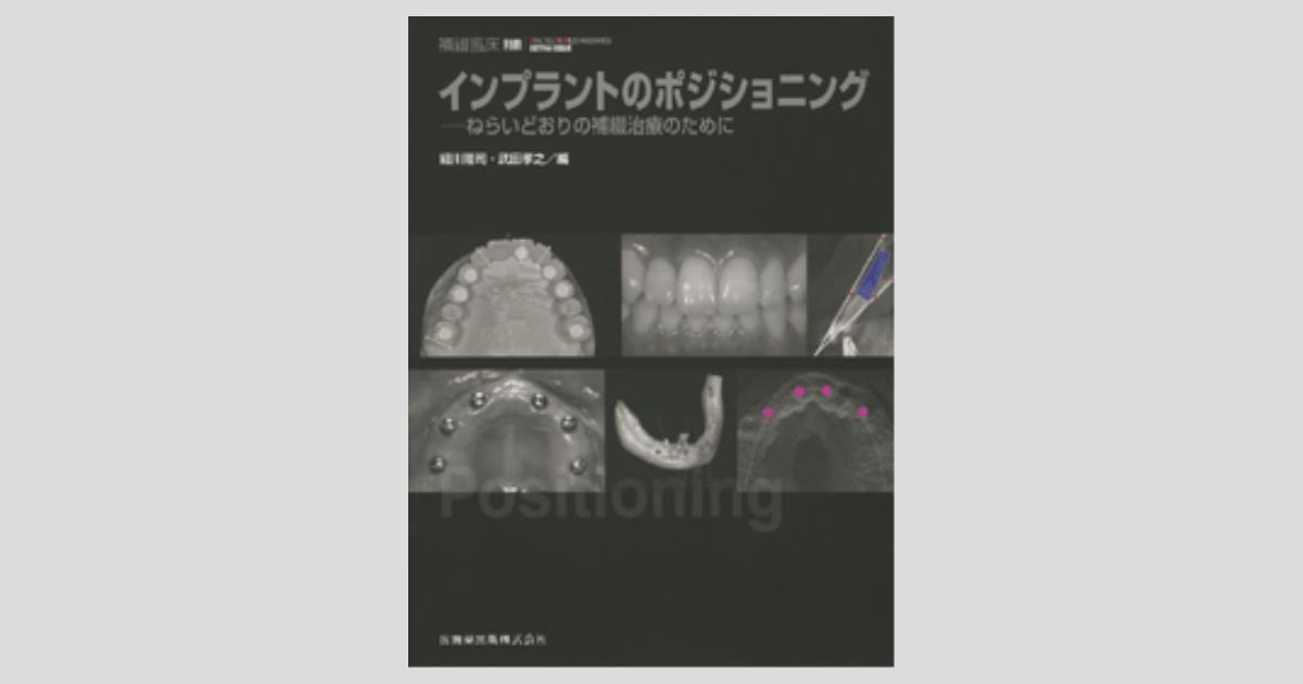 隔月刊「補綴臨床」別冊 インプラントのポジショニング ねらい