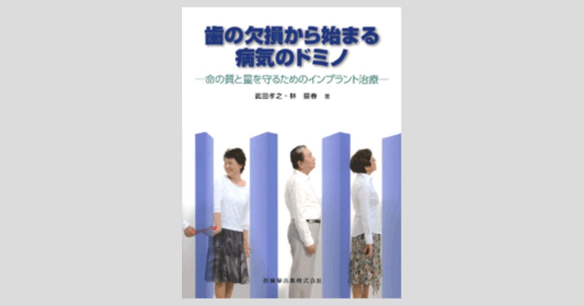歯の欠損から始まる病気のドミノ 命の質と量を守るためのインプラント