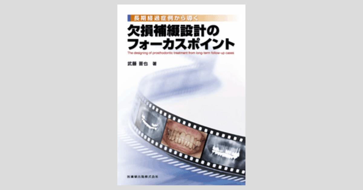 長期経過症例から導く 欠損補綴設計のフォーカスポイント/医歯薬