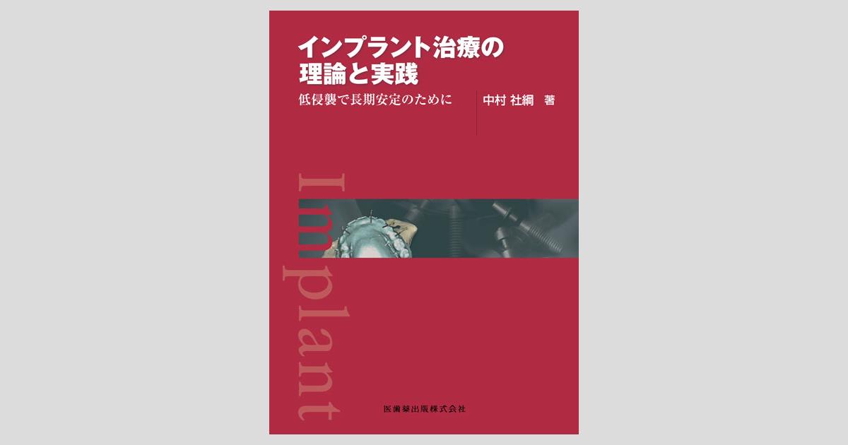 トレフォイル インプラント治療の理論と実践 (新品) - 通販 - www