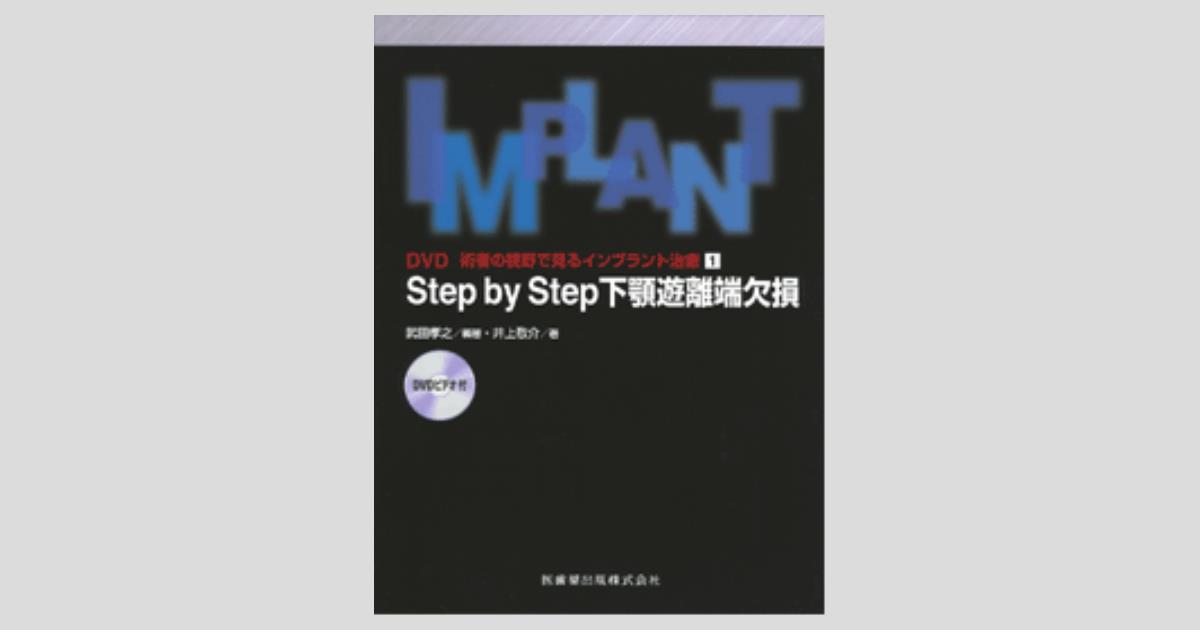 DVD 術者の視野で見るインプラント治療1 Step by Step 下顎遊離端欠損
