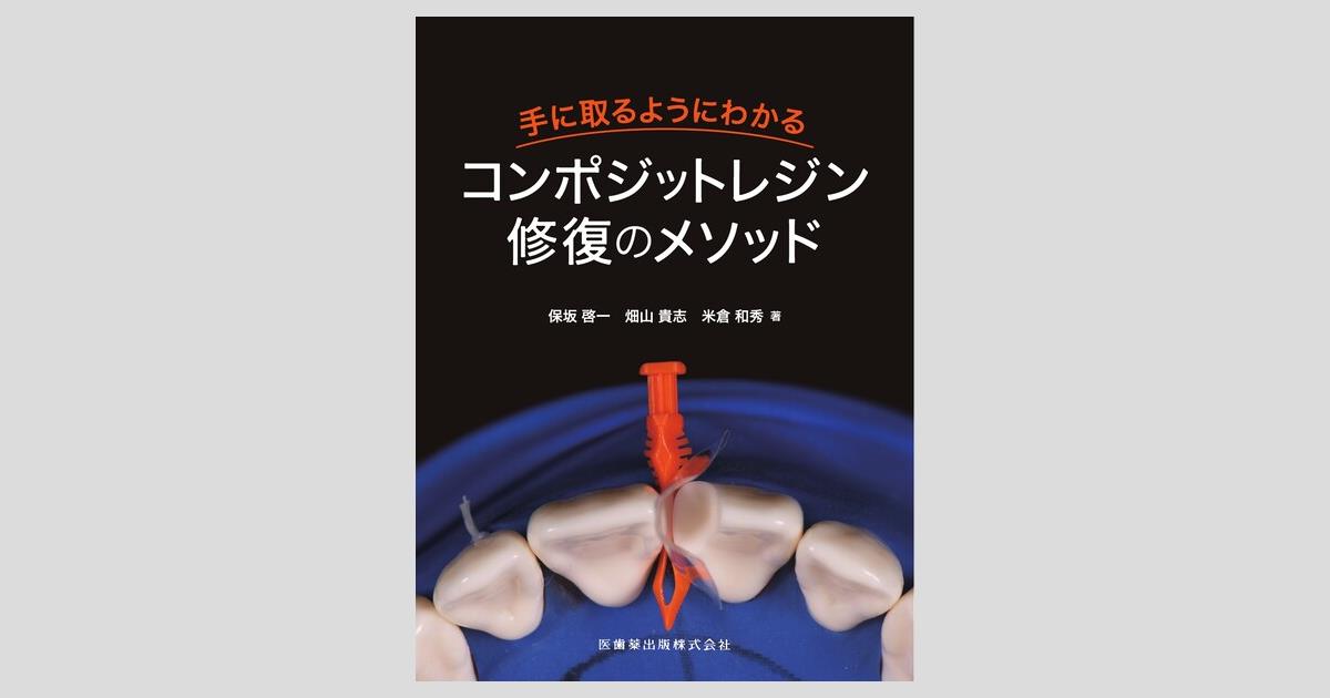 お買い得モデル 手に取るようにわかるコンポジットレジン修復の